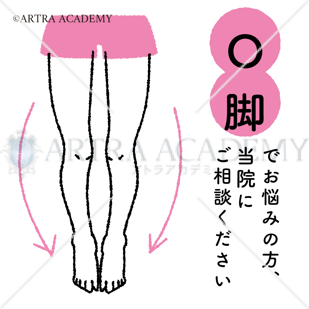 悩み〈O脚〉
