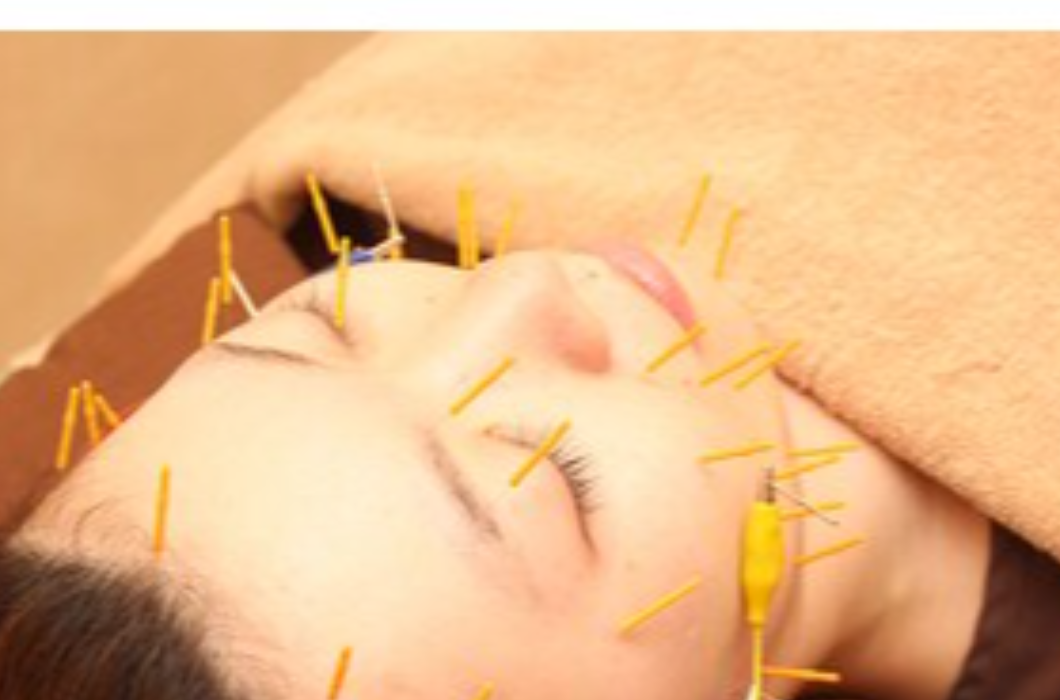 さくら鍼灸整骨院の写真2