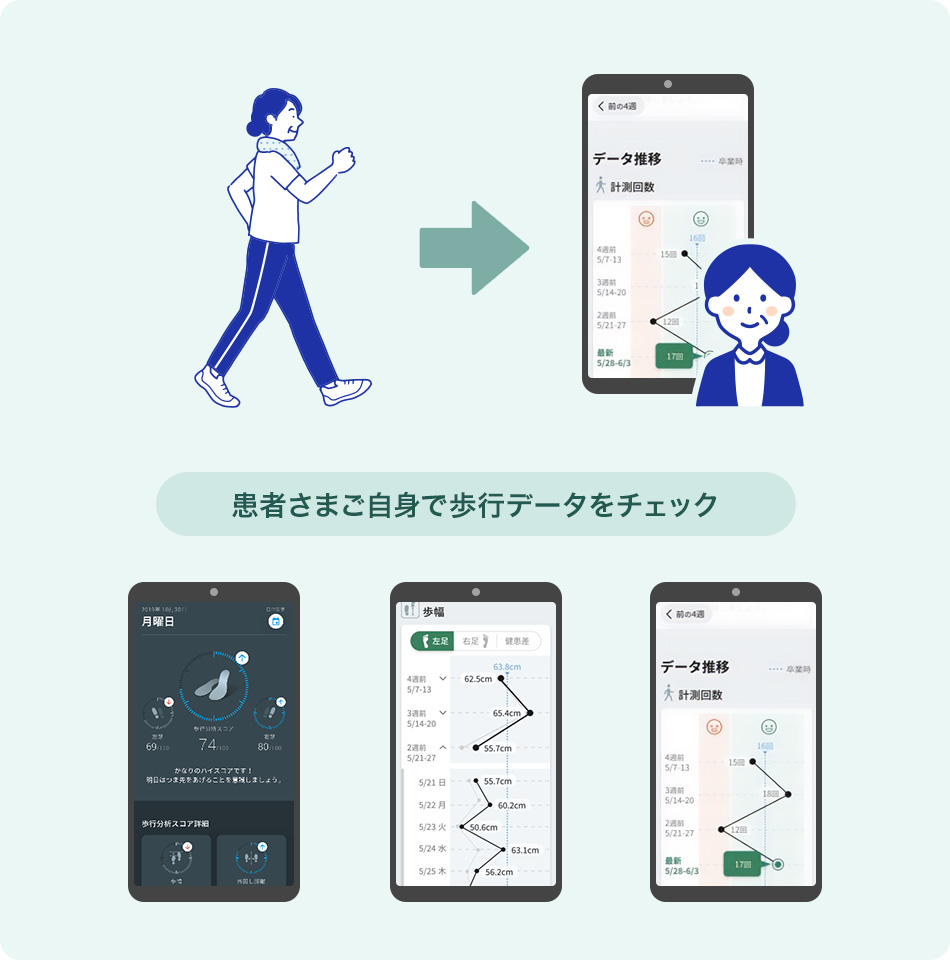 患者さまによる日常歩行の自動計測
