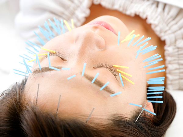 美容マロン鍼イメージ